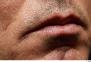  HD Face Skin Benito Romero face lips mouth scar skin pores skin texture 0001.jpg
